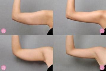 银河娱乐34岁女子健身20年练出一身肌肉被粉丝称为“肌肉夫人”(图5)